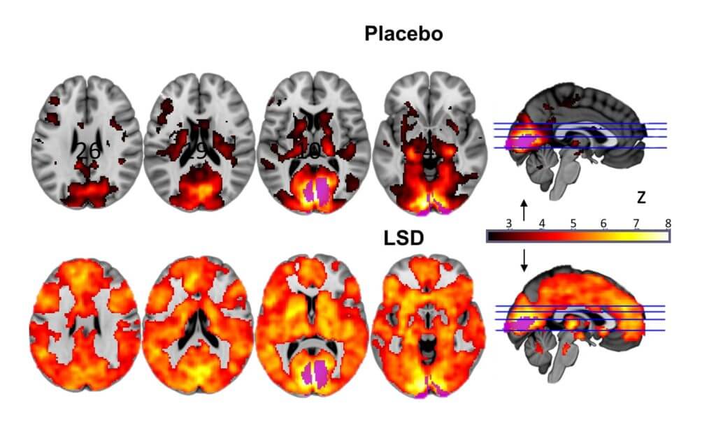 brain scan LSD third eye awakening